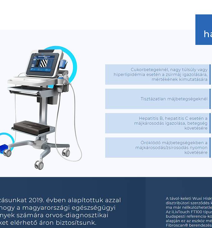 Fibromed.hu - Elasztográfiás készülékek - Reszponzív honlapkészítés